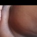 1000245772